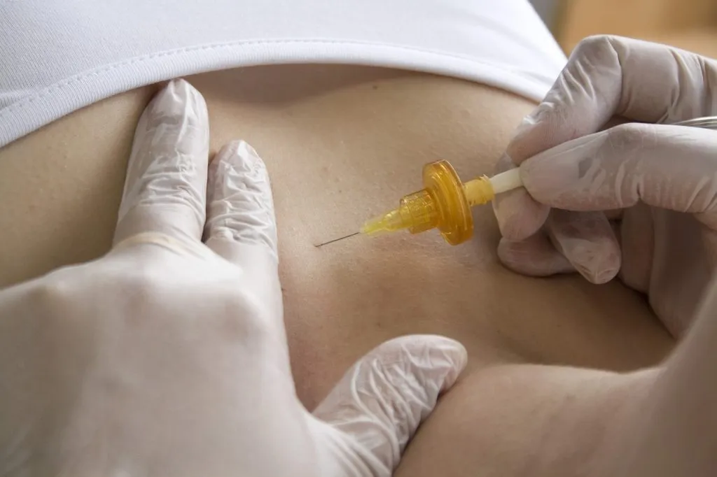 Bénéfices_médicaux_d_une_plastie_abdominale Bénéfices_médicaux_d_une_plastie_abdominale