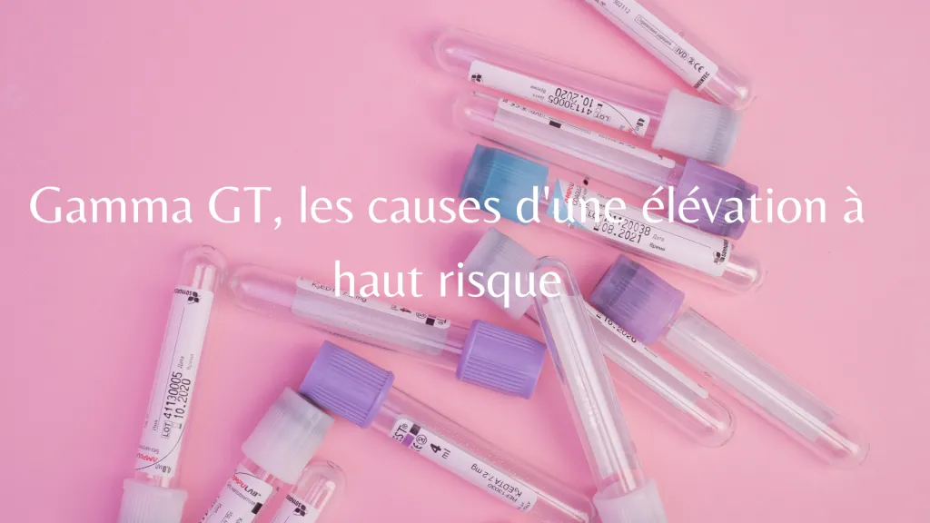 Tu préfères Le jeu à asbolument tester entre amis (2)