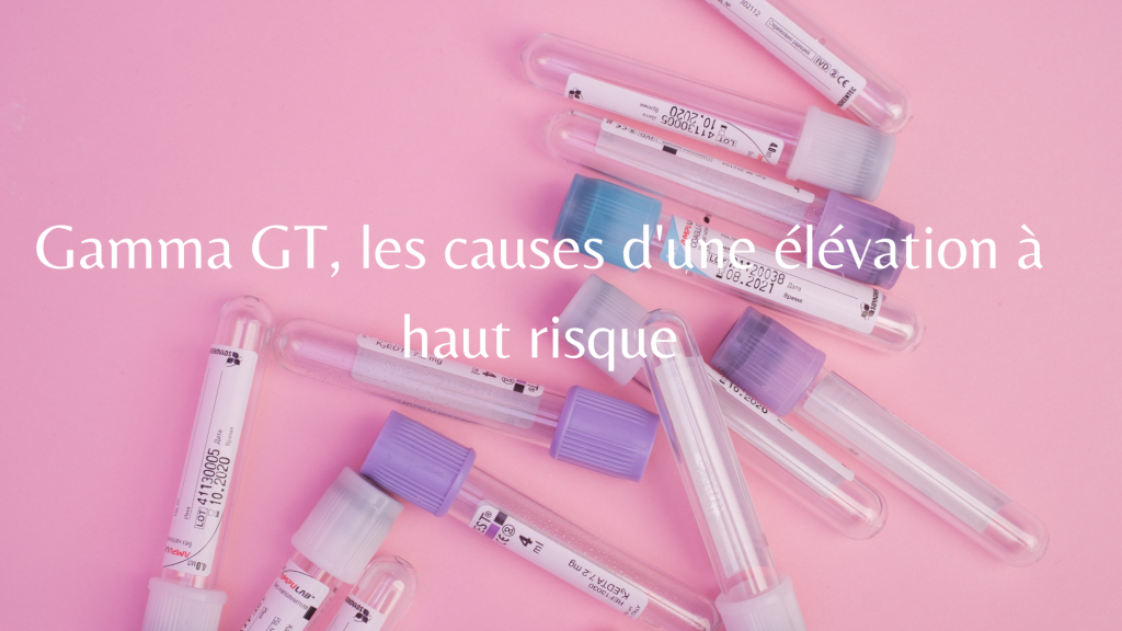 Tu préfères Le jeu à asbolument tester entre amis (2)
