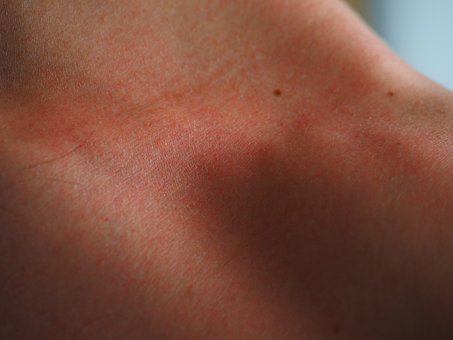 Utilisation_de_l_herbe_de_plantain_pour_les_irritations_de_la_peau_et_même_pour_l_alimentation